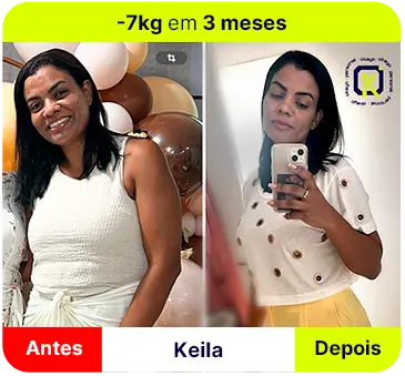 Antes e depois de Keila, 7 kg a menos em 3 meses